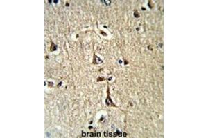 Immunohistochemistry (IHC) image for anti-Glycerol-3-Phosphate Dehydrogenase 1 (Soluble) (GPD1) antibody (ABIN3003779) (GPD1 抗体)