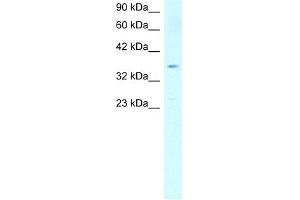 WB Suggested Anti-SCD Antibody Titration:  1. (SCD 抗体  (Middle Region))