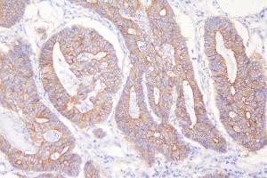 IHC analysis of DSG2 using anti-DSG2 antibody (ABIN7600803).