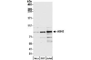 Western Blotting (WB) image for anti-Achaete-Scute Complex Homolog 2 (ASCL2) (AA 225-275) antibody (ABIN7454590)