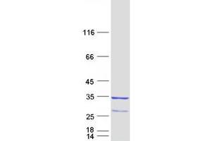 Western Blotting (WB) image for RAB23, Member RAS Oncogene Family (RAB23) (Transcript Variant 2) protein (Myc-DYKDDDDK Tag) (ABIN2730300)