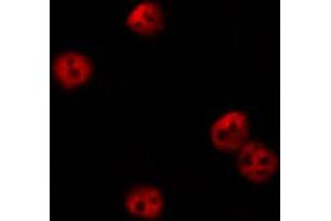 ABIN6274198 staining HeLa by IF/ICC. (CSRP1 抗体  (Internal Region))