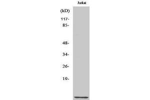 Western Blotting (WB) image for anti-CDC28 Protein Kinase Regulatory Subunit 1B (CKS1B) (N-Term) antibody (ABIN3174414) (CKS1 抗体  (N-Term))