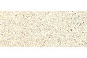 Immunohistochemistry of paraffin-embedded Human brain tissue using SPIRE1 Polyclonal Antibody at dilution of 1:60(x200) (SPIRE1 抗体)