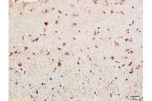 Formalin-fixed and paraffin embedded rat brain labeled with Rabbit Anti BAG2 Polyclonal Antibody, Unconjugated (ABIN755347) at 1:200 followed by conjugation to the secondary antibody and DAB staining (BAG2 抗体  (AA 151-211))
