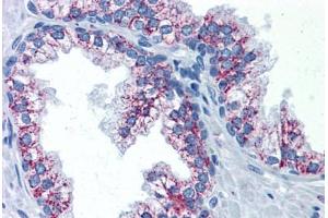 Human Prostate: Formalin-Fixed, Paraffin-Embedded (FFPE) (TAO Kinase 2 抗体  (AA 831-931))