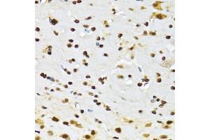 Immunohistochemistry of paraffin-embedded mouse brain using CCAR2 antibody (ABIN2563550) at dilution of 1:100 (40x lens). (CCAR2 抗体)
