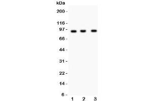 Western blot testing of NEDD9 antibody and Lane 1:  Jurkat;  2: CEM;  3: Raji lysate. (NEDD9 抗体)