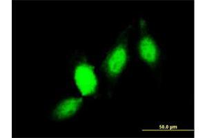 Immunofluorescence of monoclonal antibody to GSTP1 on HeLa cell. (GSTP1 抗体  (AA 1-210))