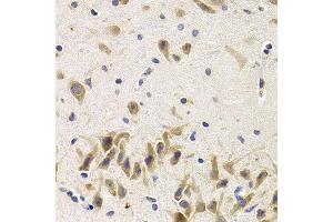 Immunohistochemistry of paraffin-embedded rat brain using UAP1 antibody at dilution of 1:200 (400x lens). (UAP1 抗体)
