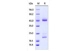 Mouse IL-23 alpha & IL-12 beta Heterodimer Protein on SDS-PAGE under reducing (R) condition. (IL12A & IL27B (AA 22-196) (Active) protein (His tag))