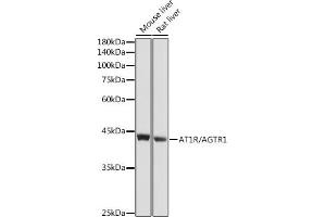 Western blot analysis of extracts of various cell lines, using R/ antibody (ABIN6133546, ABIN6136653, ABIN6136654 and ABIN6218484) at 1:1000 dilution. (Angiotensin II Type-1 Receptor 抗体  (AA 250-350))