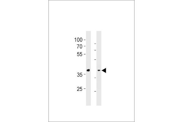 GPR4 anticorps  (AA 196-224)
