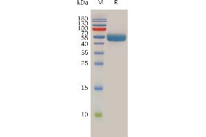 RNF43 Protein (AA 43-197) (Fc Tag)