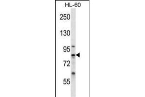 CN6 Antibody (Center) 12546c western blot analysis in HL-60 cell line lysates (35 μg/lane). (Calpain 6 抗体  (AA 390-419))