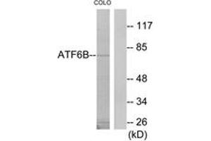Western Blotting (WB) image for anti-Activating Transcription Factor 6 beta (ATF6B) (AA 401-450) antibody (ABIN2889735) (ATF6B 抗体  (AA 401-450))