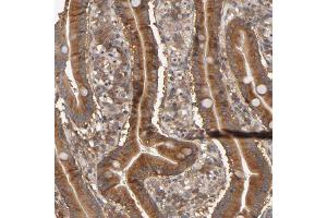 Immunohistochemical staining (Formalin-fixed paraffin-embedded sections) of human duodenum shows cytoplasmic positivity in glandular cells. (ARHGEF7 抗体  (AA 516-650))