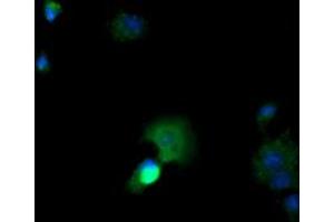 Image no. 2 for anti-Cancer/testis Antigen 1B (CTAG1B) antibody (ABIN1499889) (CTAG1B 抗体)
