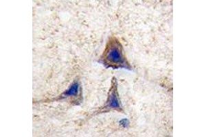 Immunohistochemistry (IHC) image for anti-B-Raf proto-oncogene, serine/threonine kinase (BRAF) (AA 424-453) antibody (ABIN3029542)