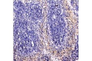 IHC testing of FFPE mouse spleen tissue with RAB27A antibody at 1ug/ml.