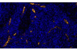 Immunofluorescence (IF) image for anti-Selectin P (Granule Membrane Protein 140kDa, Antigen CD62) (SELP) (AA 42-709) antibody (ABIN7795666)