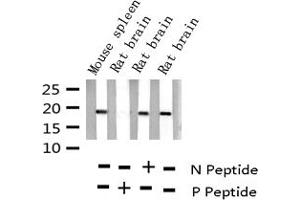 Western blot analysis of Phospho-Stathmin 1 (Ser15) expression in various lysates (Stathmin 1 抗体  (pSer15))