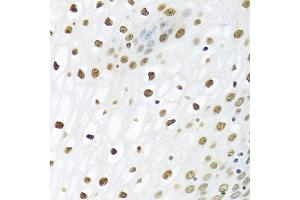 Immunohistochemistry of paraffin-embedded human esophagus using PTBP1 antibody (ABIN5995415) at dilution of 1/100 (40x lens). (PTBP1 抗体)