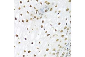 Immunohistochemistry of paraffin-embedded human esophagus using PTBP1 antibody (ABIN5995415) at dilution of 1/100 (40x lens). (PTBP1 抗体)