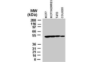 Western blot analysis of BIRC4 in various tumor cell lines recombinant BIRC4 polyclonal antibody  at 1 : 2000. (XIAP 抗体)