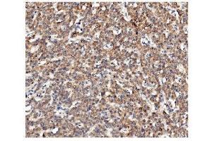 IHC analysis of Ch TOG/CKAP5 using anti-Ch TOG/CKAP5 antibody (ABIN7599106).