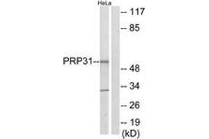 Western blot analysis of extracts from HeLa cells, using PRP31 Antibody. (PRPF31 抗体  (AA 331-380))