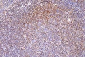 IHC analysis of DCK using anti-DCK antibody (ABIN7600254). (DCK 抗体  (AA 17-260))