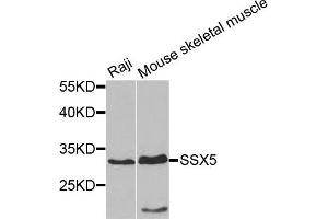 Western blot analysis of extracts of Raji and mouse skeletal muscle cells, using SSX5 antibody. (SSX5 抗体)