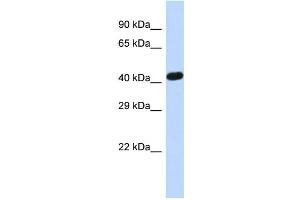 Host:  Rabbit  Target Name:  ZNF773  Sample Type:  Hela whole cell lysates  Antibody Dilution:  1. (ZNF773 抗体  (Middle Region))