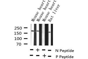 Western blot analysis of Phospho-HER2 (Tyr877) expression in various lysates (ErbB2/Her2 抗体  (pTyr877))