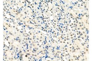 ABIN6265199 and ABIN6273321 at 1/100 staining Rat kidney tissue by IHC-P.