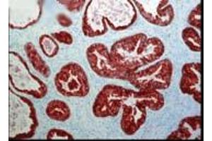 FKBP52 (Hi52C) Prostate tissue (strong staining in ductal epithelial cells Courtesy of the Mayo Clinic. (FKBP4 抗体)