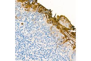 Immunohistochemistry of paraffin-embedded Human tonsil (negative control sample) using CE antibody (ABIN7266084) at dilution of 100 (40x lens). (CEACAM5 抗体)