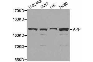 Western blot analysis of extracts of various cell lines, using APP antibody. (beta Amyloid 抗体)