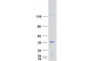 Western Blotting (WB) image for Homeobox C6 (HOXC6) (Transcript Variant 1) protein (Myc-DYKDDDDK Tag) (ABIN2723003)