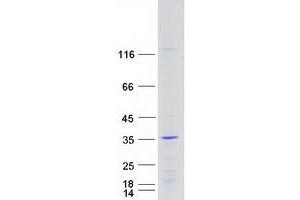 Validation with Western Blot (Homeobox C6 Protein (HOXC6) (Transcript Variant 1) (Myc-DYKDDDDK Tag))