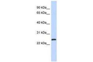 Image no. 1 for anti-Kruppel-Like Factor 16 (KLF16) (AA 71-120) antibody (ABIN6740254) (KLF16 抗体  (AA 71-120))