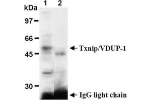 Western Blotting (WB) image for anti-Thioredoxin Interacting Protein (TXNIP) antibody (ABIN567794) (TXNIP 抗体)