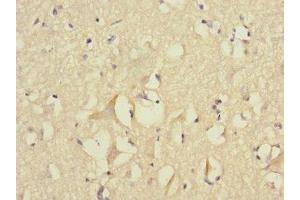 Immunohistochemistry of paraffin-embedded human brain tissue using ABIN7152777 at dilution of 1:100 (FGF12 抗体  (AA 1-181))