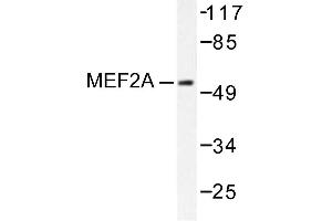 Image no. 1 for anti-Myocyte Enhancer Factor 2A (MEF2A) antibody (ABIN271871) (MEF2A 抗体)
