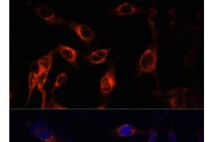 Immunofluorescence analysis of NIH-3T3 cells using TSC1 Polyclonal Antibody at dilution of 1:100 (40x lens).