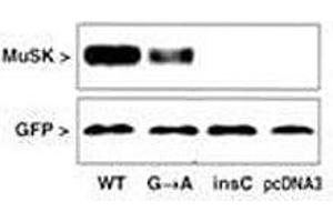 Western blot testing of COS cells after transfection with MUSK mutated and GFP (control) with MUSK antibody. (MUSK 抗体  (AA 35-65))
