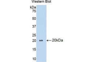 Western blot analysis of the recombinant protein. (PLA1A 抗体  (AA 309-452))