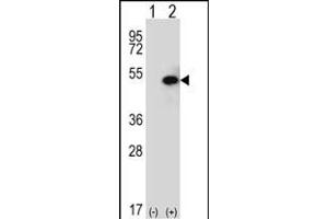 Western blot analysis of SPHK1 (arrow) using rabbit polyclonal SPHK1 Antibody (C-term ) (ABIN652302 and ABIN2837969). (SPHK1 抗体  (C-Term))