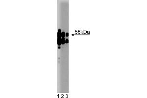 Western Blotting (WB) image for anti-Protein Phosphatase 2, Regulatory Subunit B', alpha (PPP2R5A) (AA 1-162) antibody (ABIN968065) (PPP2R5A 抗体  (AA 1-162))